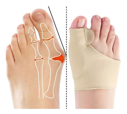 CORRECTOR DE JUANETES